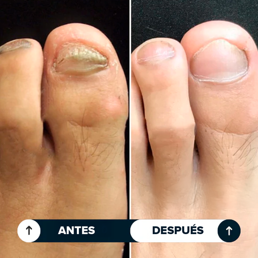 Seralia | Lápiz Antihongos