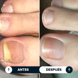 Seralia | Lápiz Antihongos