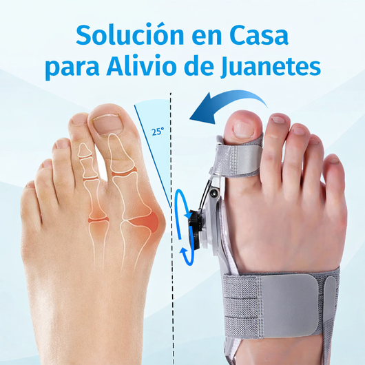Solución para juanetes
