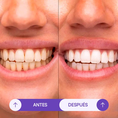 Tiras Blanqueadoras Seralia