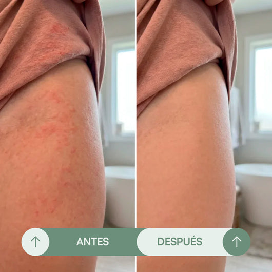 Crema para Rozaduras en Pliegues - Seralia