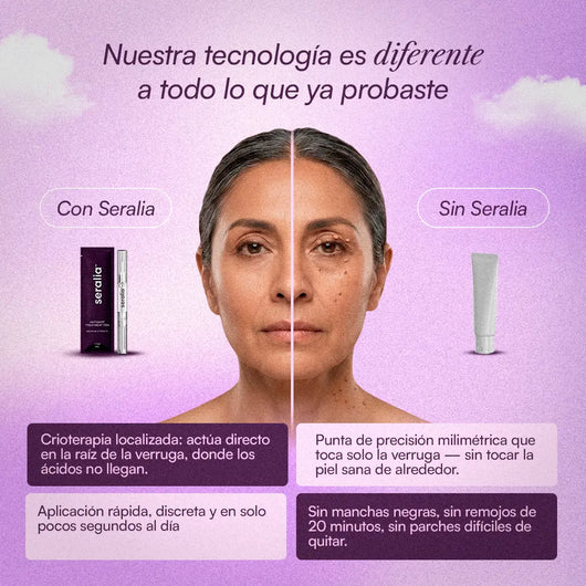 Lápiz Antiverrugas Seralia