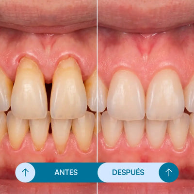 Gel Reparador Dental - Seralia