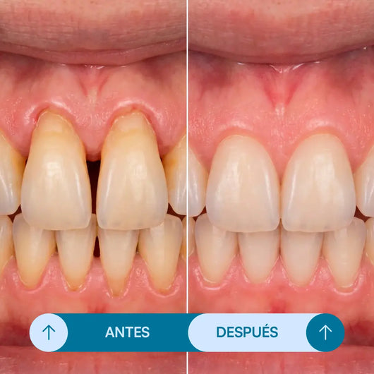 Gel Reparador Dental - Seralia