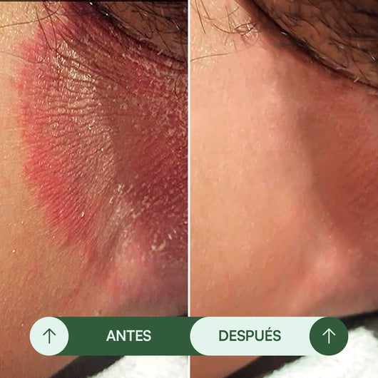 Jabón Antifúngico Seralia