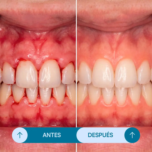 Gel Reparador Dental - Seralia