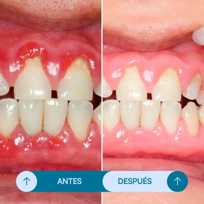 Gel Reparador Dental - Seralia